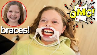 MY DAUGHTER GETS BRACES [upl. by Naugan]