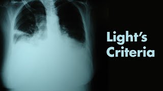 Lights Criteria amp Pleural Effusions  MEDZCOOL [upl. by Chloras]