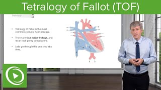 Treatments for Tetralogy of Fallot – CIMS Hospital [upl. by Siro]