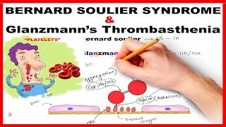 Bernard Soulier Syndrome amp Glanzmanns Thrombasthenia  Mnemonic Series  21 [upl. by Gunn578]