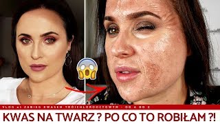 KWASY NA TWARZ  RECENZJA PEELINGU CHEMICZNEGO VLOG [upl. by Arahsal617]