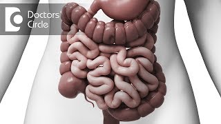 What is Intussusception in adults  Dr Nagaraj B Puttaswamy [upl. by Oyam]