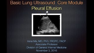 Pleural Effusion [upl. by Erkan]