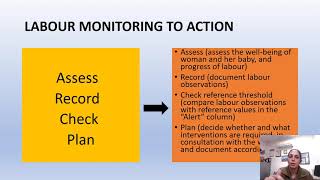 labor care guide time to change from Partogram to Labor care guide by WHO Dr Prof ArunaNigam [upl. by Atteiluj]