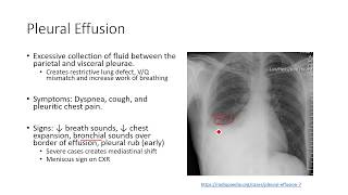 Acute Pulmonary Pathophysiology 2 Pleural Effusion [upl. by Akierdna945]