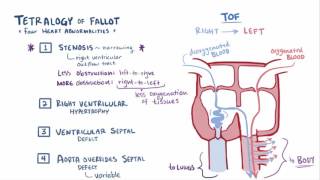 Heart Murmurs and Heart Sounds Visual Explanation for Students [upl. by Sargent941]