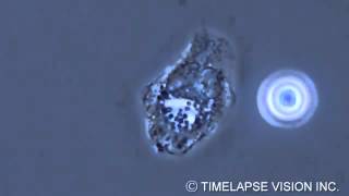 Bacterial phagocytosis by neutrophils [upl. by Pamelina]