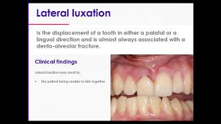 11 Traumatic Dental Injuries Part 2 Luxation Injuries Type 4 Lateral Luxations [upl. by Allenrac400]