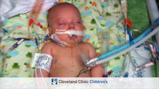 Congenital Heart Disease Tetralogy of Fallot Full Version [upl. by Anerahs848]