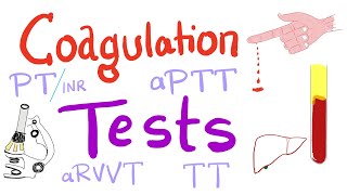 Lupus Anticoagulant LAC Practical Review [upl. by Laurie]