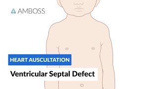 Mayo Clinic – Tetralogy of Fallot [upl. by Wagshul586]