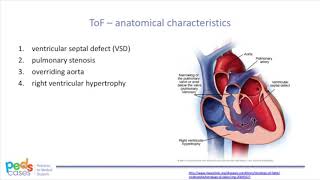 Tetralogy of Fallot Repair [upl. by Kaycee]