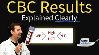 Systemic Lupus Erythematosus  Clinical Presentation [upl. by Liscomb]