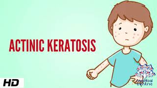 Actinic keratosis Causes Signs and Symptoms Diagnosis and Treatment [upl. by Eliga398]