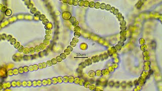 Nostoc commune  the nitrogen fixing cyanobacterium [upl. by Ihcekn]