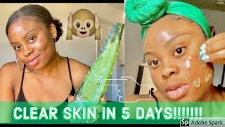 I USED FRESH ALOE VERA GEL ON MY SKIN FOR 5 DAYS amp THIS HAPPENED [upl. by Eekcaj246]