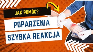 Poparzenie Co należy zrobić🚨 poparzenie [upl. by Akcira]