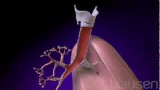 Understanding Bronchiolitis [upl. by Plath]