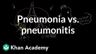 Pneumonia vs pneumonitis  Respiratory system diseases  NCLEXRN  Khan Academy [upl. by Limbert]