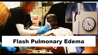 Flash Pulmonary Edema Emergency [upl. by Aleafar]