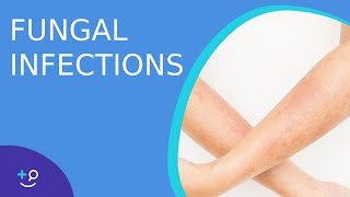 Fungal Infections  Causes Prevention and Cure [upl. by Ahsina]