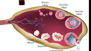 Ovarian Cysts [upl. by Reiniar]