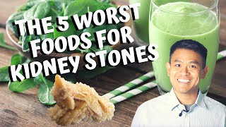 The 5 Worst Foods for Calcium Oxalate Kidney Stones  How to Prevent Getting Kidney Stones 2020 [upl. by Nayrb]